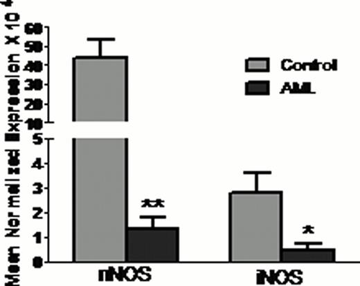 Figure 1:. Total nitrite content and NOS expression in PMNs (A) Nitrite content and (B) Expression of nNOS and iNOS in AML patients PMNs. *** p<0.001, ** p<0.01, * p<0.05 vs. Control