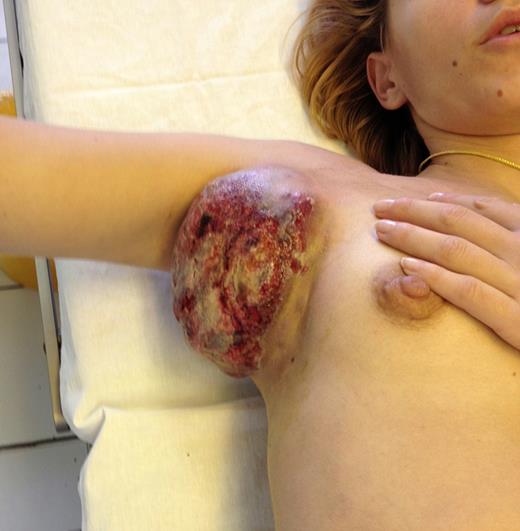 graphic