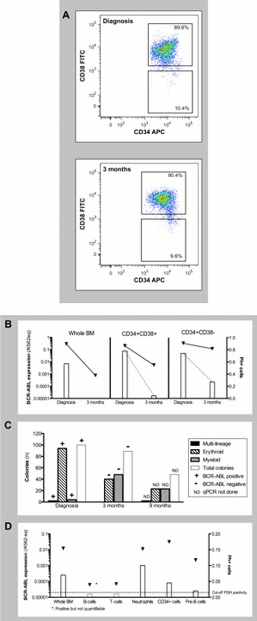 Figure 1. Delineation of stem cell biology in a CML patient presenting with isolated thrombocythemia. (A) FACS sorting of CD34+CD38− and CD34+CD38+ cells at diagnosis and 3 months after. (B) Initial treatment response in whole BM and FACS sorted CD34+CD38+ and CD34+CD38− cells. (C) Lineage involvement of the CML clone 9 months after diagnosis (after 3 months of pausing TKI treatment). (D) Growth of FACS sorted CD34+ cells in CFC-assay at diagnosis and 3 and 9 months after. : BCR-ABL expression measured by qPCR, and normalized to K562 equivalents (K562eq). : Fraction of Ph+ cells evaluated by FISH.