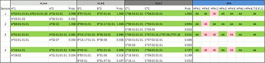 An example showing HLA-A,B,C and HPA-1,2,3,4,5,6,7,8,9,11,15 allele profiles obtained with “pool and plex” method. “Prob” denotes a Bayesian score for analyzing haplotype assignments