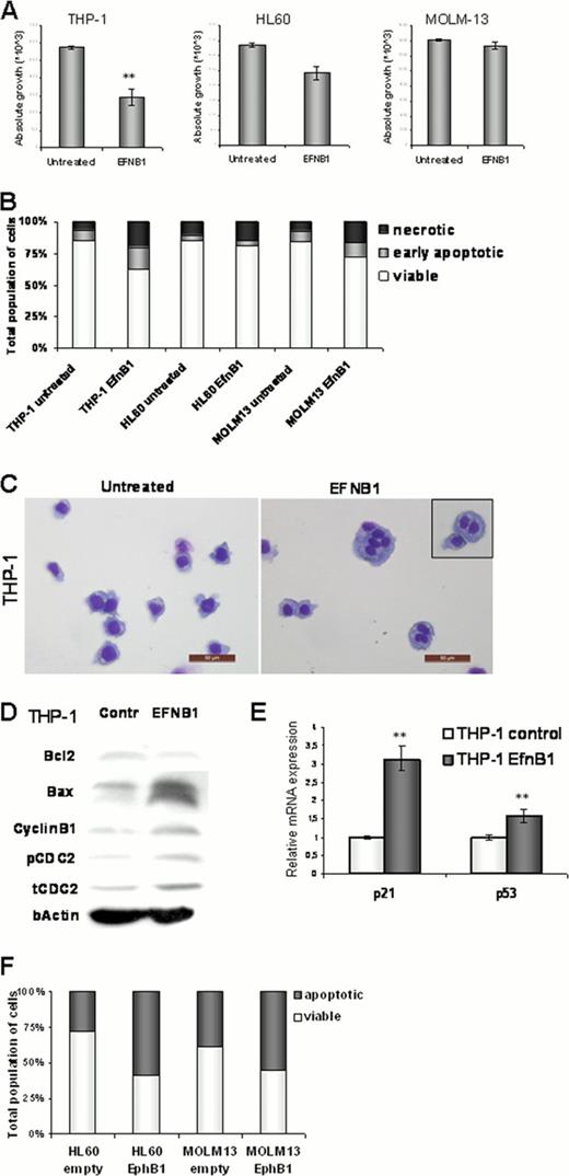 Figure 1. EfnB1 induced activation of the EphB1 in AML cell lines promotes cell cycle arrest and apoptosis