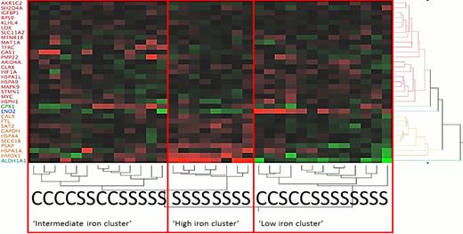 Figure. Heatmap showing unsupervised two-way hierarchical clustering of the pre-defined set of iron regulated genes on the y-axis and the clustering of study participants on the x-axis. As hypothesized, none of the controls was found to be in the high iron cluster. “S” means SCA patient; “C” means control.