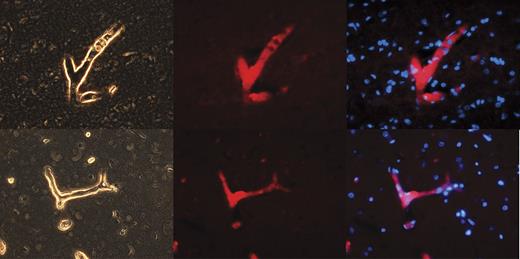 Figure 1. NPP4 is present on the vascular surfaces of human brain. To confirm the tissue localization of NPP4, we stained adult human brain with polyclonal rabbit anti-ENPP4 Ab (Proteintech Group), using Vector dylight 549 (red fluorescence Ab) to image. Strong staining was noted throughout the brain in all blood vessels, as demonstrated above in branched vessels, 2 examples of which are depicted in this figure. (Left column) Light contrast images of branched vessels. (Middle column) Red fluorescent channel of the identical field. (Right column) Overlay of DAPI channel (blue) with NPP4 protein (red). Note the strong highlighting of NPP4 in branched blood vessels and cross-sections of smaller vessels demonstrating NPP4 staining in the interior of the vessel.