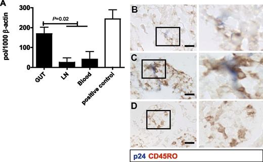 Figure 5. In vitro HIV-1 infection of CD4+ T cells derived from neonatal tissue and blood. (A) HIV-1 infection was determined using a quantitative PCR for pol proviral DNA in CD4+ T cells at day 3, expressed as the ratio pol/1000 copies of β-actin as a housekeeping gene. The results from blood and lymph nodes were combined in the Student t test because of their similar low levels. Gut-derived CD4+ T cells infected with HIV-1 contained significantly (P = .02) higher levels of pol proviral DNA than cultures with CD4+ T cells derived from blood or lymph nodes. PHA-stimulated adult CD4+ T cells from PMBC single-cell suspensions, which were used as a positive control, had comparable pol proviral DNA levels as unstimulated gut mucosa CD4+ T cells from fetuses and infants. (B-D) HIV-1 infection of intact infant gut explants was assessed by coexpression of viral p24 (blue) and CD45RO (brown). (B-C) p24 was colocalized with CD45RO in the newborn mucosa. (D) Control sample cultured without HIV-1. Scale bar indicates 0.1 mm.