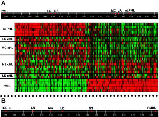 Figure 2. Relatedness of HRS cells to PMBL and nLPHL. (A) Top: Supervised PCA using PMBL versus nLPHL discriminating genes: the top 100 probe sets significantly up-regulated (≥ 4-fold change, FDR q-value < .05) by PMBL versus nLPHL and vice-versa, which correspond to 79 and 83 annotated genes, respectively. HRS cells of the 4 cHL histologic subtypes (mean, 2-7 samples each) are aligned based on their correlation to the first principal component, which captures most of the variance (75.6%, not shown) existing between the individual PMBL (n = 5) and nLPHL (n = 5) samples in the expression of the discriminating genes and therefore has PMBL and nLPHL at its extremes. Bottom: Heat map of the discriminating genes in the individual lymphoma samples (color code identical to Figure 1); in the first 2 NS cHLs from the top, the expression pattern of both PMBL and nLPHL genes is somewhat discordant with the other 5 NS cHLs. (B) Supervised PCA of HRS cells of the 4 histologic subtypes with respect to the PMBL versus TCRBL comparison: using the top 100 probe sets significantly up-regulated (≥ 4 fold change, FDR q-value < .05) by PMBL versus TCRBL and vice-versa, which correspond to 85 and 76 named discriminating genes, respectively. Displayed is the correlation of HRS cells from the various cHL histologic subtypes with the first principal component, accounting for 77.9% (not shown) of the total variance existing between the individual PMBL (n = 5) and TCRBL (n = 4) samples in the expression of the discriminating genes.