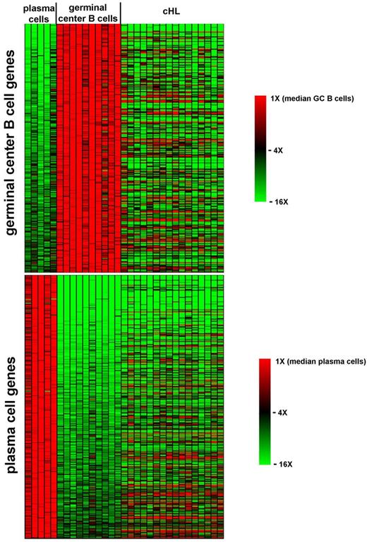 Figure 3. HRS cells and the transition from GC B cells to plasma cells. Heat map of the expression pattern in individual plasma cell (n = 5), GC B cell (n = 10), and HRS cell (n = 16) samples of the 262 (top) and 363 (bottom) probe sets robustly up-regulated (≥ 5 fold change, FDR q-value ≤ .027) by GC B cells over plasma cells and vice-versa, respectively.