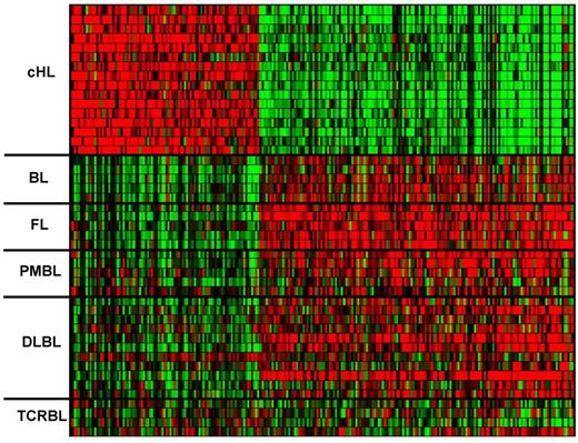 Figure 4. Comparison of HRS cells with B-NHL cells. Heat map of the expression pattern in the individual primary neoplastic cell samples of the 235 probe sets discriminating between HRS and B-NHL cells (≥ 4-fold change, q ≤ .005). Color code identical to Figure 1.