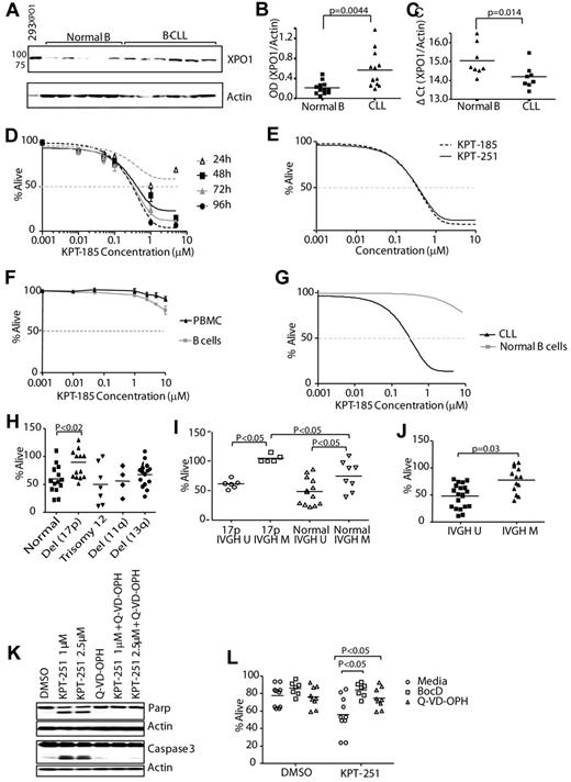 Figure 3. KPT-185 induces selective cytotoxicity in CLL cells. (A) CD19+ cells from CLL patients (N = 13) and normal donors (N = 12) were examined for XPO1 expression by immunoblot. Results are shown from 1 of 2 identical experiments. (B) Data analysis of band intensities measured in 2 immunoblots of CLL patient and normal B-cell samples (XPO1/actin ratio). (C) RNA was extracted from CD19+ cells from CLL patients (N = 8) or normal donors (N = 8). XPO1 expression was determined by real-time RT-PCR analysis. Ct values are relative to actin. Higher relative Ct values represent lower gene expression. (D) KPT-185 induces a time and dose-dependent cytotoxicity of CLL cells as measured by MTS assay (N = 10 per timepoint). (E) KPT-185 and KPT-251 induce comparable level of cytotoxicity of CLL cells at 72-hour time-point as measured by MTS assay (N = 6 each). (F) KPT-185 is not cytotoxic to normal PBMC and isolated B cells as measured by annexin-V/PI flow cytometry (N = 6 each). (G) Comparison of the cytotoxic effect of KPT-185 on CLL versus normal B cells as measured by MTS assay (N = 8 each). (H-J) Cytogenetic abnormalities and IVGH mutational status were examined for differences in response to KPT-185 of CLL cells. (K-I) Treatment with SINEs promotes cell death through a caspase-dependent pathway. CLL patient cells were treated with various concentrations of KPT-251 for 12 or 24 hours in presence or absence of the caspase inhibitor Q-VD-OPH. Lysates derived from these cells (12 hours) were assessed for cleavage of PARP and caspase 3 by immunoblot analysis. (L) Apoptosis was measured at 24 hours by annexin-V/PI flow cytometry.