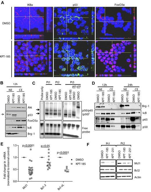 Figure 4. SINEs-specifically inhibit nuclear export. (A) Confocal fluorescence microscopy for p53, FoxO3a, and IκB show time-dependent increases in nuclear levels of these proteins in KPT-185 treated cells compared with vehicle control. Results shown are representative of 5 experiments. Z stacks were collected (0.4 μm per slice) and images were chosen from the middle of nuclei. Side views (across bottom and side of figures) are also shown. (B) Nuclear and cytosolic fractions were isolated from KPT-185 treated CLL cells (12 and 24 hours) and analyzed by immunoblot for AKT, FoxO3a, IκB, p53, and BRG1. Results shown are from 1 representative patient sample. (C) CD19+ cells from CLL patients (N = 3) were incubated with 1μM KPT-185 for 12 hours. EMSA was done with nuclear extract using a radio-labeled oligonucleotide containing a consensus NF-κB binding site. KPT-185–treated samples were also incubated with antibodies specific to the p65 or p50 subunits of NF-κB. The p65/p50 complex is indicated by arrows. Results are shown from 3 of 3 experiments. (D) Nuclear and cytosolic fractions were isolated from KPT-185 treated CLL cells (12 and 24 hours) and analyzed by immunoblot for p50 and p65, and BRG-1. Results shown are from 1 representative patient sample. (E) Real-time RT-PCR for Mcl1, Bcl-2, and Bcl-xL after 12 hours (0.5μM) KPT-185 treatment. Data are normalized to 18S transcript and represented as fold change in expression of KPT-185 treated relative to the vehicle control. Squares represent individual patient samples, and horizontal bars represent the average. (F) Whole cell expression of Mcl1 and Bcl-2. Results shown are from 2 representative patient samples.