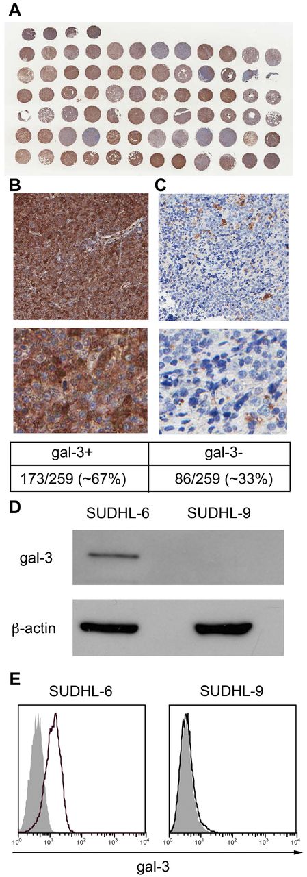 Figure 1. DLBCL cells express and secrete gal-3. (A-C) Tissue array of 259 primary DLBCL tissue sections was analyzed for gal-3 expression by immunohistochemistry. (A) Low-power magnification of a portion of the tissue array stained for gal-3. (B) DLBCL tissues that showed cytoplasmic staining of tumor cells were scored as gal-3+. (C) Samples in which stromal cells expressed gal-3 but no gal-3 expression was detected in tumor cells were scored as gal-3−. SUDHL-6 and SUDHL-9 cell lines derived from patients with DLBCL were analyzed for total gal-3 expression by immunoblot (D) and gal-3 cell-surface expression by flow cytometry (E). For panel E, cells were fixed before staining to retain cell-surface gal-3.