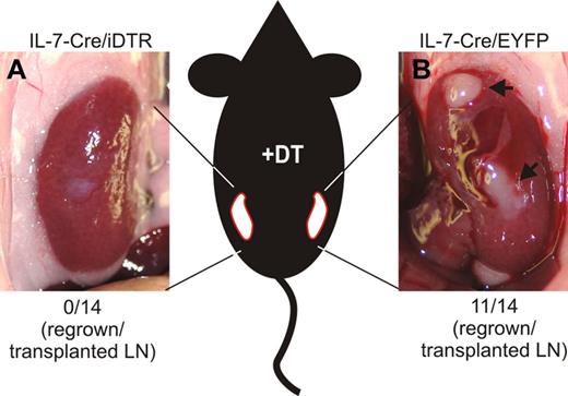 Figure 7. Importance of IL-7–expressing stromal cells for LN regeneration. Inguinal LNs of IL-7–CrexR26-iDTR and IL-7–CrexR26-EYFP mice were transplanted under the kidney capsule of C57BL/6 mice. Between weeks 4 and 8 after transplantation, recipients were treated with DT (20 ng/g body weight) twice weekly. (A) LN remnants of IL-7–CrexR26-iDTR LNs. None of the 14 transplanted LNs had regenerated. (B) Fully regenerated IL-7–CrexR26-EYFP LNs from the contralateral kidney. Eleven of 14 transplanted LNs had regenerated.