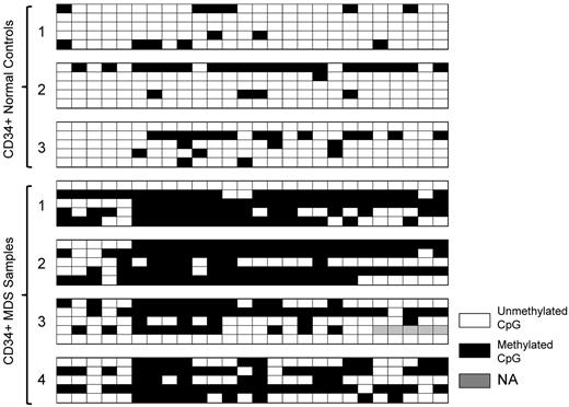 Figure 3. rRNA promoter methylation by sodium bisulfite sequencing. DNA samples derived from CD34+ healthy subjects and MDS patients were treated with sodium bisulfite, PCR amplified, cloned, and sequenced. Each row represents an individual clone. The open squares represent unmethylated CpGs, closed squares represent methylated CpGs, and gray squares indicate that data were not obtained. One of the CpGs (CpG 6 in Figure 2) reported in the published rDNA sequence (accession number U13369) was found to be missing when individual clones were sequenced.