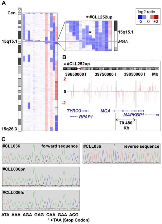 Figure 1. Microdeletions in band 15q15.1 involving the MGA locus. (A) Inferred log2-ratio of SNP copy number data on chromosome 15q (median smoothing with a window of 5 consecutive markers; losses are indicated in blue, gains in red). Eight deletions are covering the MGA locus, the other 5 are located in close vicinity to a maximum distance of 1.373 Mb. (B) Raw log-ratio, chromosome 15 (case number CLL252up) displayed with the UCSC genome browser (hg18). Red bars represent the determined log2 ratio of single probe sets sorted by their physical position along the chromosome. Shown is the smallest deletion on 15q15.1 within the MGA locus, 70.48 kb in size. (C) Forward and reverse sequence analysis of exon 17 revealing a subclonal nucleotide exchange C → T in position 6143 that codes for a premature stop codon in case number CLL036. This sequence variation was not detectable in the nontumor reference sample (case number CLL036pn) and in a follow-up sample taken after treatment (case number CLL036fu).