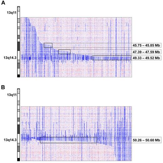 Figure 2. Proximal and distal breakpoint clusters on chromosome 13q. Inferred log2 ratio of copy number data on 13q of all cases carrying a 13q deletion. Three proximal (A) and 1 distal (B) breakpoint cluster at the chromosomal positions indicated were identified visually after arranging the cases by their centromeric and telomeric breakpoints.