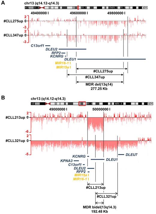 Figure 3. Minimal consensus regions of monoallelic and biallelic del(13)(q14). Raw log2 ratio (chromosome 13; samples from case numbers CLL275up, CLL347up, CLL213, and CLL321) blotted to the UCSC genome browser (hg18). The minimal monoallelic (A) deleted region encompasses DLEU1 and the first exons of DLEU2, but not the 2 miRNAs, whereas the minimal biallelic (B) deleted region encompasses only DLEU1.