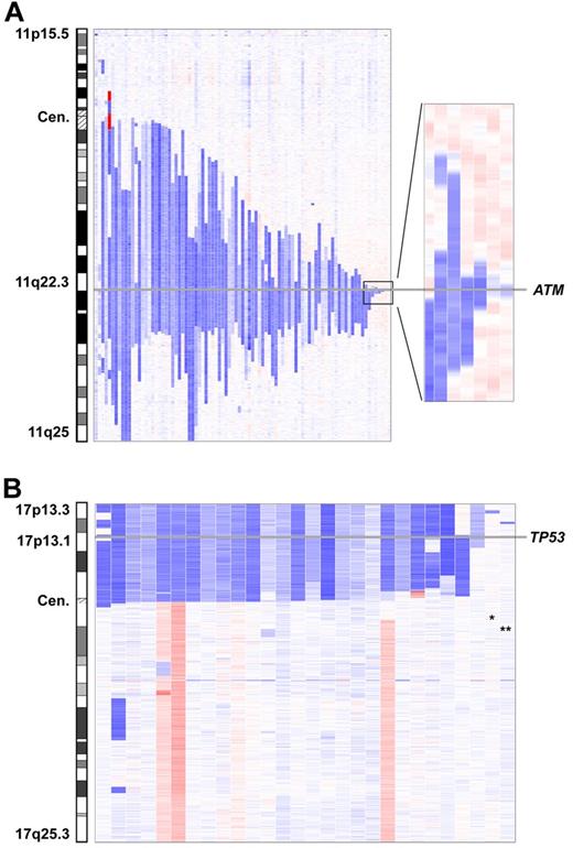 Figure 4. Minimally deleted region of del(11)(q22.3) and del(17p13). (A) The smallest deletion in 11q22.3 has a size of 78.5 kb and is located within the ATM locus. (B) Involvement of the TP53 locus in all 17p-deleted patients except 2. The 2 deletions not encompassing TP53 are small deletions on 17p13.3 (*) and 17p13.2 (**).