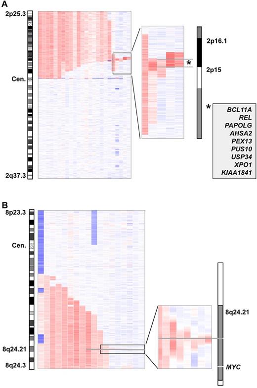 Figure 5. Minimally amplified region of gain(2p) and gain(8q). (A) The minimal region in bands 2p16.1-p15 is defined by 2 patients, has a size of 1.909 Mb, and harbors 9 genes. (B) Minimal consensus region of gain(8q) with focus on a 60-kb region in 8q24.21 located approximately 500 kb centromeric of the MYC locus.
