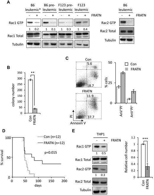 Figure 6. FRATN blocks Rac activation and inhibits leukemia induction by MLL-ENL. (A) Western blot analysis of Rac1 and GTP and total Rac1 in preleukemic and leukemic wild-type B6ME (B6) and F123ME (F123) cells, transduced with control and FRATN-expressing retroviral vectors. Rac2 GTP and total Rac2 are also shown in leukemic B6ME cells. Numbers represent densitometric quantitation of Rac GTP levels normalized to total Rac protein bands. α-tubulin served as a loading control. Data were obtained from individual preleukemic and leukemic cell lines in each case and are representative of 3 independent experiments. *The leukemic B6ME Rac1 blot shown is a shorter exposure compared with the other lanes. (B) Number of colonies formed in methylcellulose by purified hCD2T+ leukemic wild-type MLL-ENL cells transduced with control (Con) and FRATN-expressing (FRATN) retroviral vectors. Bars represent means of duplicate values; and error bars, the SD. **P < .01 versus control. Data are representative of 4 independent experiments. (C) Plots represent apoptosis in leukemic wild-type MLL-ENL cells 5 days after transduction with control and FRATN-expressing retroviral vectors. Bar chart represents the mean percentages of early-stage (annexin V+PI−) and late-stage (annexin V+PI+) apoptotic cells in triplicate cultures; and error bars, the SD. Data are representative of 4 independent experiments. (D) Kaplan-Meier survival curves for mice transplanted with wild-type MLL-ENL leukemic cells, after transduction with control and FRATN-expressing retroviral vectors. Group numbers are shown. These data are representative of 2 independent experiments. (E) Western blot analysis of Rac1 and Rac2 GTP and total Rac in human THP1 cells transduced with control (−) and FRATN-expressing (+) lentiviral vectors (left panel). Numbers represent densitometric quantitation of Rac GTP levels normalized to total Rac protein bands. α-tubulin served as a loading control. Graph represents relative cell number-transduced THP1 cells as measured by MTS assay. Bars represent mean values obtained from 3 independently transduced cultures; and error bars, the SD. ***P < .001 versus control. (A-D) At 48 hours after transduction, hCD2T+ transduced cells were positively selected by MACS and either used directly for the experiments (A-B,D) or equivalent numbers plated into culture and analyzed 3 days later (C).