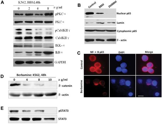 Figure 5. Berbamine inhibits CaMKII γ-dependent NF-κB, β-catenin, and Stat3 without affecting its upstream target PKCα. (A) Effect of berbamine on PKCα, CaMKIIγ, IKK-α, and IkBα. (B-C) Berbamine analogs blocked nuclear translocation of NF-κB p65 realed by Western blot (B) and immunofluorescent staining (C). (C) Immunofluorescent image results exhibited a significant decrease of nuclear NF-κB p65 of leukemia cells after treatment of berbamine. Cells were immobilized on coverslips, fixed, permeabilized, and subjected to immunostaining of p65 (red fluorescence) and nuclear counterstaining (blue). Scale bars, 10 μm. (D-E) Berbamine inhibited CaMKIIγ downstream targetsβ-catenin (D) and Stat3 (E) of leukemia cells. Leukemia cells were treated with berbamine at various concentrations for 48 hours and harvested for analysis of upstream (PKCα) and downstream (IKK-α, IkBα,NF-κB p65, β-catenin and Stat3) targets of CaMKIIγ using Western blotting or immunofluorescent staining.
