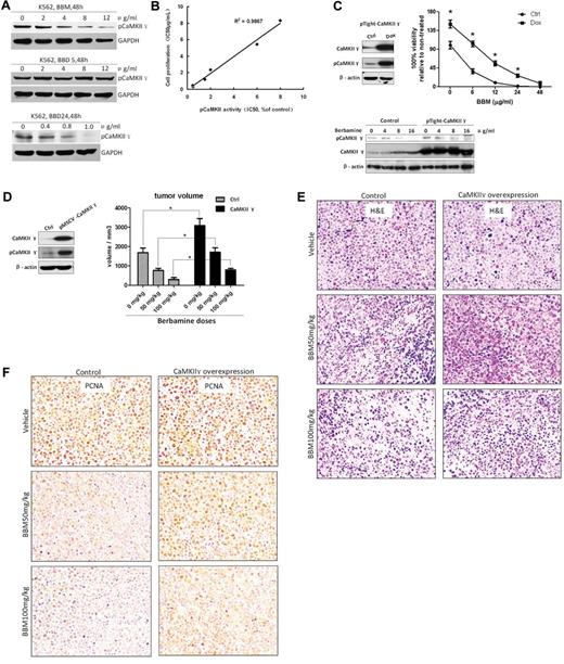 Figure 6. Correlation between inhibition of CaMKIIγ kinase activity and inhibition of leukemia cell proliferation by berbamine analogs. (A) Berbamine (BBM) and 2-methylbenzoyl berbamine (BBD24) inhibited phosphorylation of CaMKIIγ of leukemia cells. BBM or BBD24 treatment reduced phosphor-CaMKIIγ protein level, but not total CaMKIIγ protein level of K562 cells. Leukemia cells were treated with BBM or BBD24 at the indicated concentrations for 48 hours, and then total proteins were extracted for Western blot analysis for phosphor and total CaMKIIγ proteins. BBD5 was served as an inactive berbamine analog. (B) Correlation between inhibition of CaMKIIγ kinase and inhibition of cell proliferation by analogs of berbamine (BBM, BBD3, BBD12, BBD15, BBD24, and CP15; R2 = 0.9867). (C) Overexpression of CaMKII γ attenuated berbamine-induced growth inhibition of leukemia cells in vitro. Control or CaMKII γ overexpression cells were treated with BBM at the indicated concentrations for 48 hours, and then collected for analysis of cell viability by MTT assay, and phosphor and total CaMKIIγ proteins by Western blot. β-actin was used as loading control (* P < .01). (D) Overexpression of CaMKII γ reduced berbamine-induced growth inhibition of xenograft tumors in a dose-dependent manner (*P < .01). (E-F) hematoxylin-eosin (E) and PCNA (F) stain of xenograft tumors from NOD-SCID mice dosed with vehicle (top), BBM 50 mg/kg (middle), and BBM 100mg/kg (bottom). Left: A representative of control groups. Right: A representative of CaMKIIγ overexpression groups.
