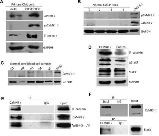 Figure 7. High expression of CaMKIIγ is associated with leukemia stem cells of CML. (A-C) CaMKIIγ was highly activated in leukemia stem cells (LSCs) with a concomitant increased β-catenin(g) but not in normal hematopoietic cells (HSCs) and normal blood cells. LSCs and HSCs were sorted from primary CML samples of CML patients at blast crisis and normal cord blood samples, respectively, using FACS. (D) CaMKIIγ increased β-catenin and phospho-Stat3 proteins of leukemia cells. K562 cells were transfected with CaMKIIγ expression vector for 48 hours and then analyzed for β-catenin and Stat3 proteins by Western blot. (E-F) β-catenin and Stat3 protein physically interacted with CaMKIIγ in leukemia cells. Leukemia cell lysates were incubated with CaMKIIγ or Stat3 antibody, and the immune complexes were then purified, separated by SDS-PAGE, and immunoblotted with β-catenin, Stat3, or CaMKII γ antibody.