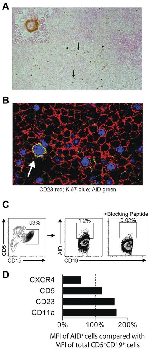 Figure 2. CLL cells in infiltrated LNs express AID protein. (A) Representative low-power (100× original magnification) and high-power (600× original magnification, inset) views of AID+ cells in an infiltrated CLL LN. Scattered AID+ cells (black arrows), which are larger than the majority of cells, are present and have the morphology of paraimmunoblasts (inset). (B) Representative high-power confocal photomicrograph of CLL LN (600× original magnification) showing cells expressing the CLL marker CD23 (red). Several cells are Ki-67+ (blue). An AID+Ki-67+ cell (green) is indicated by the white arrow. (C) Flow cytometry of dispersed LN cells. The percentage of AID+ cells was determined by comparison of samples with and without the use of a peptide that specifically blocks binding of the AID Ab. At least 1% CD5+CD19+ were AID+. (D) Graph showing the mean fluorescence intensity (MFI) of CXCR4, CD5, CD23, and CD11a in AID+ cells compared with the total CD5+CD19+ sorted population using the same gating as in panel C.