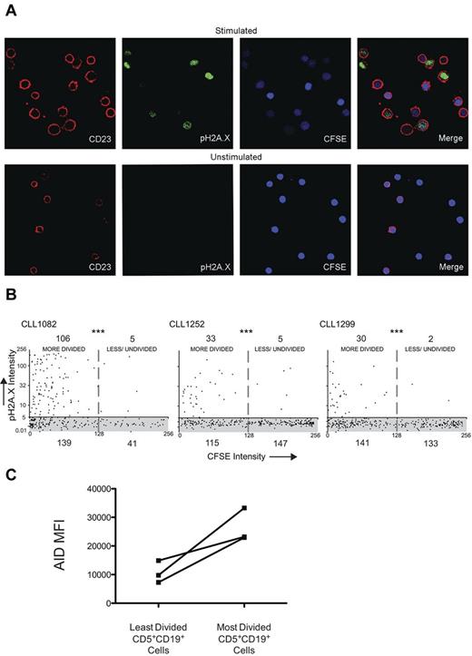 Figure 4. CLL cells that divided and up-regulated AID protein exhibited more dsDNA breaks. (A) Confocal photomicrographs comparing CLL PBMCs stimulated in the CD40 + IL-4 system with unstimulated cells cocultured only with CD32-transfected fibroblasts. Original magnification was 630×. (B) Quantitative colocalization of CFSE intensity (x axis) and anti-pH2A.X staining (y-axis) on CD23+ cells derived from stimulated cultures. The shaded area (gray) represents the range of pH2A.X intensity derived from unstimulated cells, all of which had a CFSE intensity of at least 256 pixels; numbers denote the quantity of cells present in each of the 4 quadrants. ***P < .0001 by Fisher exact test. (C) Graph showing the change in AID mean fluorescence intensity (MFI) identified in CD5+CD19+ cells of the same 3 samples in panel B as determined by flow cytometry.