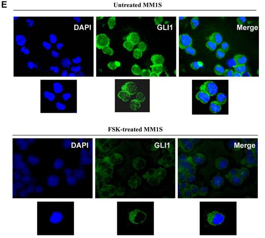 Figure 2. Expression of Hh components in MM cell lines. (A) MM cell lines were double-stained with anti-CD138–APC and anti-Shh–PE Abs, and the percentage of positive cells was analyzed by a FACSCanto II flow cytometer. Shh is expressed in CD138+ as well CD138− population. (B-D) MM cells were stained with 2 different anti-Ptch1 primary Abs (B) or anti-Smo primary Abs (C-D) followed by specific FITC-conjugated secondary Abs and analyzed with flow cytometry. For both Ptch1 and Smo, similar staining patterns were observed. In both experiments, background staining has been excluded using cells stained with secondary Ab FITC-conjugated as negative control. (C) Lower panel: Smo immunoblot of protein lysate from MM cell lines fractionated by electrophoresis and stained with anti-Smo Ab showing basal level of Smo expression in MM cell lines. (E) MM1S cells were cultured in control medium (top panel) or in the presence of forskolin (FSK; 10μM; bottom panel) for 24 hours. FSK inhibits the nuclear translocation of Gli1. Immunocytochemical analysis was assessed using anti-Gli1Ab, and 4,6-diamidino-2-phenylindole was used to stain nuclei. The cells were analyzed using an epifluorescence microscope (Nikon Eclipse E800, Nikon) and a Photometrics Coolsnap CF color camera (Nikon). (E) Original magnification ×100. Gli1 expression and its nuclear localization suggestive of Hh pathway activity were observed in MM cells. The inhibition by FSK suggests a Smo-independent activation of Gli1.
