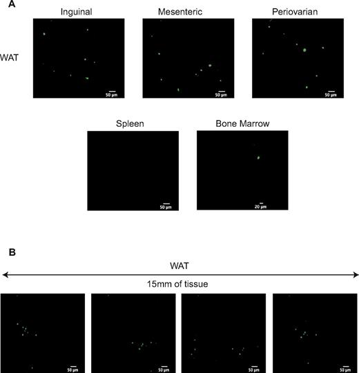 Figure 4. In vivo cell imaging of immune cells derived from WAT-KLS cells. 1000 GFP+ WAT-KLS cells were IV coinjected with 2.105 GFP− total BM cells into lethally irradiated CD45.2 syngenic mice. One month after injection, videos of intrafemoral BM, spleen, and WAT were performed to track GFP+ cells. (A) Frames of 20-35-second videos acquired at the surface of these organs (spleen and WAT) or inside the length of the femur showing the GFP+ cells observed. Results are representative of 3 independent animals. (B) Successive pictures of 15 mm of WAT observed with the confocal macroprobe.