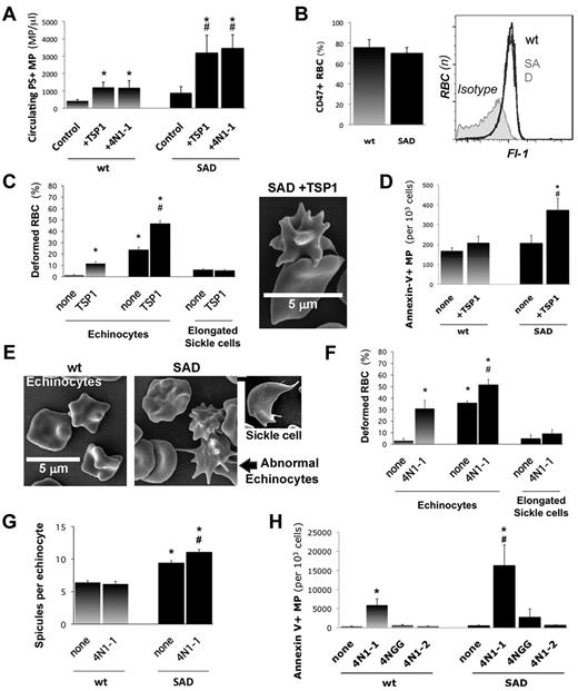 Figure 2. TSP1 triggers MP shedding via CD47. (A) We injected recombinant TSP1 intravenously to wild-type (WT) and SAD mice (1 mg/kg). Within 10 minutes, we collected platelet-free plasma to quantify circulating PS+ MPs by FACS after annexin-V labeling. (*P < .05 vs controls, #P < .05 vs wild-type +TSP1. (B) We determined the surface expression of CD47 on WT and SAD RBC by FACS, expressed in percent (left). Plot of CD47-labeling in Fl-1 (right). (C-D) SAD and WT RBCs were placed in polyvinylpyrrolidone. Shear rate was applied with an ektacytometer (1500 seconds−1; 2.5 minutes) with or without addition of TSP1 (20 μg/mL). RBCs were prepared for scanning electron microscopy. (C) Biconcave discocytes, spicule-covered echinocytes, and elongated sickle cells were quantified by phase-contrast microscopy (SAD in solid bars; *P < .05 vs WT controls, none; #P < .05 vs SAD control, none). (D) Supernatant PS+ MPs were quantified by FACS after annexin-V labeling (*P < .05 vs SAD controls; #P < .05 vs wt+TSP1). In other experiments, WT and SAD RBCs were treated with 4N1-1, or control peptides 4N1-2 and 4NGG (10μM; 10 minutes) in RPMI-1640. (E) SAD and WT erythrocytes treated with 4N1-1. (F) Biconcave discocytes, spicule-covered echinocytes, and elongated sickle cells were quantified (SAD in solid bars; *P < .05 vs WT controls, none; #P < .05 vs WT+TSP1 control, none). (G) Spicules on WT and SAD echinocytes were counted (*P < .05 vs control wild-type RBC, none; #P < .05 vs SAD controls). (H) Supernatant PS+ MPs were quantified by FACS after annexin-V labeling (*P < .05 vs controls, none; #P < .05 vs WT+TSP1).