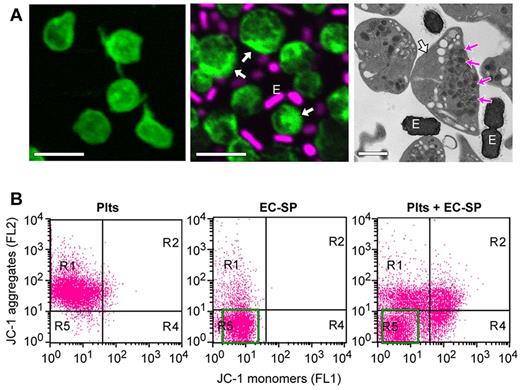 Figure 1. E coli induces apoptotic-like features in platelets. (A) Platelets were incubated for 8 hours alone (left) or with E coli (EC-SP), an isolate from the bloodstream of a patient diagnosed with sepsis (middle and right). Left and middle: Confocal microscopy of polymerized actin (phalloidin, green stain) and DNA (topro 3, magenta stain) in platelets and EC-SP (E), respectively. Far right: Transmission electron micrograph of the platelet and EC-SP (E) suspension cultures. The white arrows point to lateral condensation of polymerized actin, whereas the magenta arrows (right) identify granules that have moved to one side of the cell. Scale bars = 2 μm in the left and middle, 1 μm in the right. These micrographs are representative of 3 independent experiments. (B) Mitochondrial membrane potential (ΔΨm) in platelets or EC-SP that were cultured (8 hours) alone (left and middle) or together (right). Bacteria population in middle and right panels is indicated by green box. This flow cytometric experiment is representative of 3 independent studies. The green box identifies the major population of EC-SP.