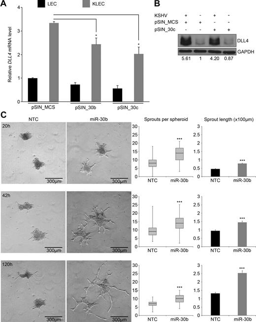 Figure 3. Regulation of DLL4 by miR-30b and miR-30c has relevance in pathophysiologic settings. (A) DLL4 mRNA expression in LECs or KLECs infected with miR-30b and miR-30c–expressing lentiviruses measured by qRT-PCR (means + SEM, n = 3). Expression is relative to LECs infected with empty vector, pSIN_MCS. Differences between pSIN_MCS-infected and pSIN_30b/30c-infected KLECs were significant (*P < .05). (B) DLL4 protein expression in LECs measured by Western blotting. Values indicate intensity of DLL4 antibody ECL plus signal normalized to GAPDH antibody ECL signal and relative to KSHV−/pSIN_MCS+. (C) Left panels: Representative photographs at indicated time points of HUVEC spheroids embedded in matrigel. HUVECs were transfected with mimic before being induced to form spheroids. Photographs were taken on an Axiovert 100 microscope (Zeiss) using an AxioCam (Zeiss) at 5× magnification in phase contrast. Images were acquired using AxioVision (Zeiss). Middle panels: Quantification of total sprouts per spheroid (y-axis) at indicated time points (n = 60). Box plot indicates inter-quartile range, whiskers indicate total range, black line denotes median. Sprouts were counted using Adobe Photoshop CS2. The difference between NTC-transfected and miR-30b–transfected cells was significant (***P < .001). Right panels: Quantification of average sprout length (y-axis; means + SEM, n = 20). Average sprout length was measured using the segmented lines tool in Image J (National Institutes of Health) and are displayed on the y-axis as ×100 μm. Five sprouts were measured per spheroid. The difference between NTC-transfected and miR-30b–transfected cells was significant (***P < .001).