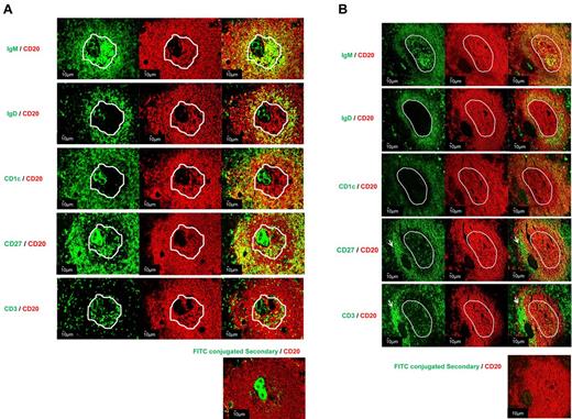 Figure 4. Detailed characterization of PLNs within spleens from ITP patients. Sections from 4 spleens (3 ITP and 1 control) were examined by double immunofluorescence staining: CD20 (red) with IgD (green), CD1c (green), CD27 (green), or IgM (green). (A) PLN (ITP) and (B) GC (control). The white outline indicates the location of the structures, PLNs and GCs, determined by IgM staining. The presence of T cells in PLNs was analyzed by CD3 (green) and CD20 staining. The arrows designated a T-cell area (B). Control for nonspecific binding was performed on spleen sections using FITC-secondary antibodies and CD20 (red). The sections were analyzed by confocal microscopy using a Zeiss LSM 710 confocal or a Zeiss Axio Imager Z1 fluorescence microscope (×200 magnification; Carl Zeiss).
