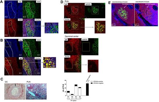 Figure 5. Detection of IgM-ICs bound to the FDC network in PLNs identified in ITP spleens. Sections from 2 ITP spleens were analyzed by immunofluorescence to examine the distribution of (A) DAPI to stain nuclei, CD20 (red), and CD35 (green), and (B) DAPI, IgM (red) and CD35 (green). After staining, the sections were analyzed by confocal microscopy using a Zeiss LSM 710 confocal (×200 magnification; Carl Zeiss). The white ellipse designed using Zen 2010 software represents a proliferating lymphoid nodule identified with IgM staining. (C) Detection of GPIV in ITP spleens: PLN (white arrow) and GC (black arrows); ×200 magnification. (D) The proportion of PLNs identified as containing GPIIb/IIIa was analyzed in 4 ITP spleens versus a control spleen and representative GC and PLN. At least 3 sections of 3 different spleens were analyzed from each specimen; n corresponds to the number of PLN analyzed. (E) DAPI to stain nuclei, CD20 (red), and GPIIb/IIIa (green) on the left or GPIV (green) on the right of the figure. The arrow designated 1 PLN positive from ITP spleen.