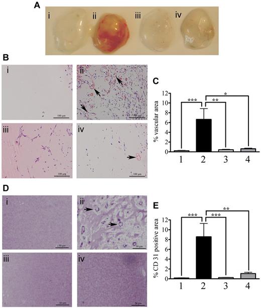 Figure 1. Human ProS inhibits Matrigel vascularization in vivo. (A) Matrigel plugs obtained from mice that were injected subcutaneously in the flank, with 0.4 mL of Matrigel alone (lane 1, control), Matrigel containing a mixture of proangiogenic factors (400 ng/mL bFGF, 400 ng/mL VEGF-A, and 50 units/mL heparin, plug 2) or human ProS at 25 μg/mL (plug 3) or a mixture of proangiogenic factors (bFGF at 400 ng/mL, VEGF-A at 400 ng/mL, heparin at 50 units/mL) supplemented with 25 μg/mL human ProS (plug 4). (B) Representative micrographs of hematoxylin and eosin-stained sections of Matrigel plugs under the experimental conditions; Matrigel alone (i, control), Matrigel containing a mixture of proangiogenic factors (ii, 400 ng/mL bFGF, 400 ng/mL VEGF-A, and 50 units/mL heparin) or human ProS at 25 μg/mL (iii) or a mixture of proangiogenic factors (bFGF at 400 ng/mL, VEGF-A at 400 ng/mL, and heparin at 50 units/mL) supplemented with 25 μg/mL ProS (iv). The arrows indicate vascular structures with lumens and red blood cells. (C) Quantification of vascular structures with lumens and red blood cells within Matrigel sections. (D) Representative micrographs of CD31 immunstaining of Matrigel plugs under the various experimental conditions; Matrigel alone (i, control), Matrigel containing a mixture of proangiogenic factors (ii, 400 ng/mL bFGF, 400 ng/mL VEGF-A, and 50 units/mL heparin) or human ProS at 25 μg/mL (iii) or a mixture of proangiogenic factors (bFGF at 400 ng/mL, VEGF-A at 400 ng/mL, and heparin at 50 units/mL) supplemental with 25 μg/mL ProS (iv). the arrows indicate blood vessel stained with CD31. Quantifications were performed from Matrigel plugs obtained from 3 independent experiments. Within each experiment and for each experimental condition, 3 individual plugs implanted in individual animals were analyzed. From each Matrigel plug, 3 sections were stained and analyzed. Results are expressed as percentage vascular area (C) or percentage CD31-positive area (E) ± SEM, using Fiji-win32 software. ***P < .001. **P < .01. *P < .05.