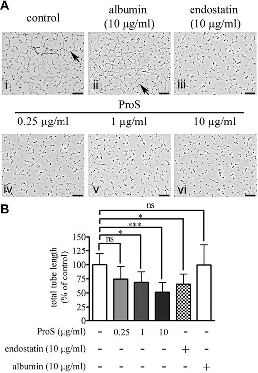 Figure 2. Human ProS inhibits the capacity of EC to form capillary-like networks in vitro. (A) The in vitro morphogenesis assay. ECs (105 cells/well) were cultured for 24 hours in EBM-2 medium containing 0.5% FCS in 24-well plates coated with Matrigel containing the indicated concentrations of human ProS, endostatin, or albumin. Cells were then fixed and the cell 3-dimensional organization was photographed using a MVX10 microscope. On the pictures, arrows indicate examples of tube formation, and each black scale represents 1 mm length. (B) The quantification of total tube length of capillary-like structures by automatic counting using the AngioQuant Version 1.33 software. Data from 4 independent experiments, each in duplicate, are expressed as percentages of control values form untreated cells ± SD. ***P < .001. *P < .05. ns indicates not significant.