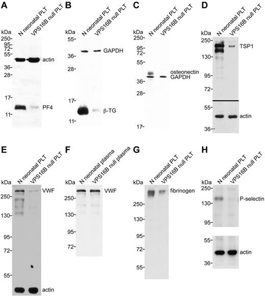 Figure 6. α-granule protein deficiencies in VPS16B null platelets. Immunoblots comparing platelet (PLT) whole-cell lysates or plasma from VPS16B null and normal (N) neonatal sources as indicated for each lane. Significantly reduced PF4 (A), β-TG (B), TSP1 (D), VWF (E), and fibrinogen (G) content in VPS16B null platelets (lane 2) compared with control neonatal platelets (lane 1) were observed. Platelet osteonectin (C) and P-selectin (H) were undetectable in VPS16B null platelets (lane 2) compared with normal neonatal (lanes 1). (F) In contrast, VWF was present at roughly equivalent quantities (0.5 μL plasma/lane) in VPS16B null plasma (lane 2) compared with normal neonatal plasma (lanes 1). Lysate from equivalent numbers of platelets was loaded on each gel. Equivalent protein loading is indicated by visualizing actin or GAPDH on the same immunoblot. Panels A through C were probed and developed simultaneously using primary rabbit antibodies (PF4, β-TG, osteonectin) and mouse antibodies (actin, GAPDH). (A-D) Reduced 15% SDS-PAGE. (E-F,H) Reduced 8% SDS-PAGE. (G) Nonreduced 8% SDS-PAGE.