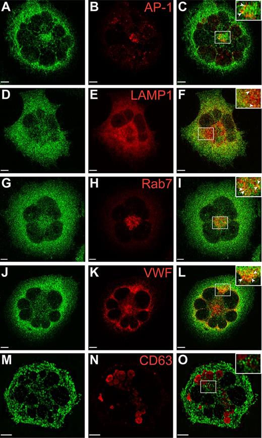 Figure 7. Localization of GFP-VPS16B within stable megakaryocytic Dami cells. Dami cells stably transfected with GFP-VPS16B fusion protein (green) were costained with different intracellular markers (red) as indicated. Merged images are shown on the right of each row (C,F,I,L,O). Partial colocalization (merge) of GFP-VPS16B is observed with the trans-Golgi network (AP-1, A-C), late endosomes/lysosomes (LAMP1, D-F), late endosomes (Rab7, G-I), α-granules (VWF, J-L) but not δ-granules (CD63, M-O). Insets with arrows highlight areas of colocalization. Multilobed nuclei are readily observed in Dami cells stimulated with phorbol ester and TPO. Representative z-stack images are shown. The white bar represents 5 μm. Images were obtained using a Leica DMIRE2 inverted fluorescence microscope equipped with a Hamamatsu C9100-12 back-thinned EM-CCD camera and Yokogawa CSU 10 spinning disk confocal scan head (with Spectral Aurora Borealis upgrade), with 63×/1.4 objective lenses. Data were acquired and processed using the PerkinElmer Volocity Verison 5.1.1 software.