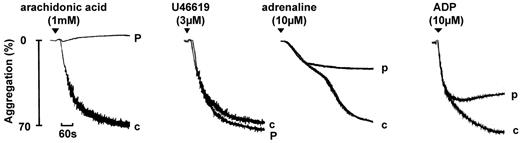 Figure 2. Aggregation in a participant diagnosed with a TxA2 pathway defect. Aggregation in a participant (p) diagnosed with a TxA2 pathway defect. The TxA2 pathway defect also results in the abolition of response to arachidonic acid (1mM) and impairment in response to other agonists, including ADP and adrenaline, but not to U46619, indicating a defect in arachidonic acid metabolism. “c” indicates control (healthy volunteer). The pattern of aggregation is representative of other participants diagnosed with a defect in arachidonic metabolism.