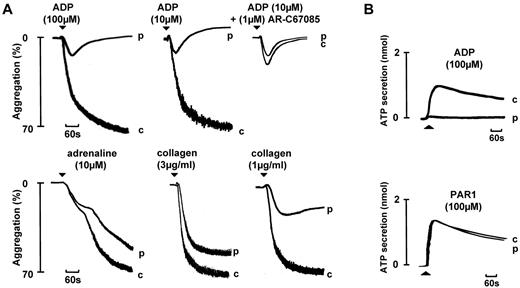 Figure 4. Aggregation and secretion in a participant with a homozygous P2Y12 mutation that prevents receptor expression. Aggregation and secretion in a participant (p) with a homozygous mutation in P2Y12 that introduces a frame-shift mutation early in the coding sequence (c.36delG, p.Gly12fs). Responses are shown alongside a control (c). The PRP platelet count in the control and participant were 4.1 × 108/mL and 3.9 × 108/mL, respectively.