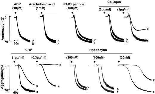 Figure 5. Aggregation and secretion in a participant with a GPVI-like defect. Aggregation in a participant (p) diagnosed with a GPVI-like defect on the basis of a reduced response to CRP and to rhodocytin. A similar pattern of aggregation was observed in other participants diagnosed with a GPVI-like defect. “c” indicates control.