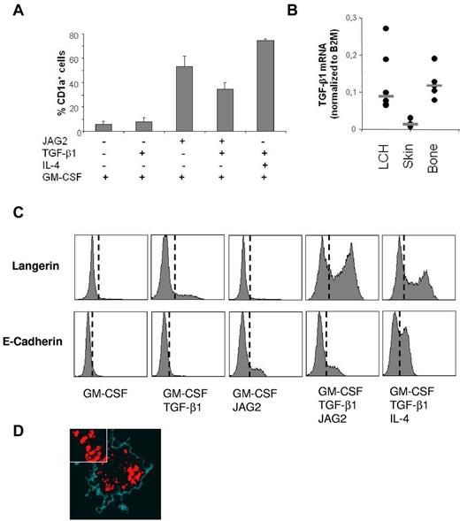 Figure 3. JAG2 induces an LCH-like phenotype in vitro. Monocytes were cultured with the indicated cytokines in the presence of JAG2 or control transfected CD45− MS5 feeder cells for 5 days. Cells were collected and stained for CD45 to allow separation of monocyte-derived cells from feeder cells, along with Abs against the LCH-associated markers CD1a and Langerin. (A) Induction of CD1a shown as the percentage of CD1a+ cells among the CD45+ population. (B) Detection of TGF-β1 mRNA in frozen biopsy material taken from LCH lesions and from healthy human skin and bone. TGF-β1 expression is normalized to B2M. (C) CD1a+ cells were further analyzed for the coexpression of Langerin and E-cadherin. Histogram plots show Langerin and E-cadherin expression of CD1a+CD45+ cells shown in panel A. (C) DCs generated in the presence of GM-CSF, TGFβ1, and JAG2. Langerin staining (red) reveals the presence of numerous rod-shaped Langerin+ organelles in the cytoplasm indicative of the presence of Birbeck granules. Cell borders were determined by phase contrast (cyan).