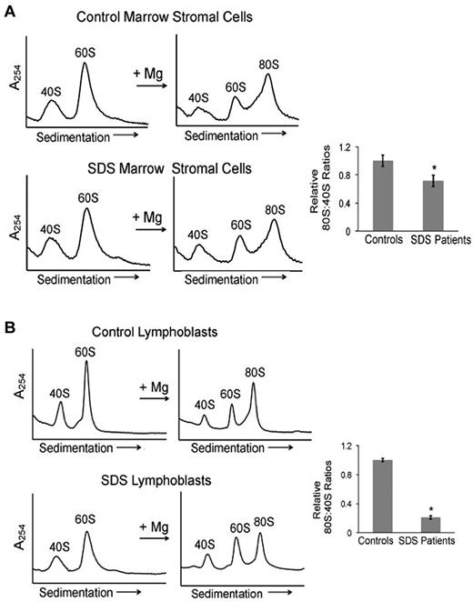 Figure 3. Ribosomal subunit association is impaired in SDS patient cells. (A) Bone marrow stromal cells or (B) lymphoblasts from healthy controls or SDS patients were lysed in 0.25mM MgCl2 to dissociate the 40S and 60S ribosomal subunits (left panels). MgCl2 was added (+Mg →) to an aliquot of each lysate to test the ability of the 40S and 60S ribosomal subunits to form 80S monomers (right panels). The resulting ribosomal profiles were analyzed by sucrose gradient sedimentation. Representative assays are shown. The resulting 80S:40S ratios were quantitated for 3 healthy controls versus 4 SDS patients of different SBDS genotypes as noted in the text; *P < .05.