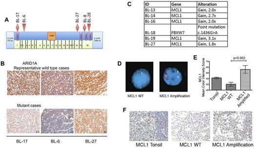 Figure 2. Primary BL cases demonstrate recurrent alterations in ARID1A and MCL1. (A) Representation of ARID1A gene and mutations identified by sequencing. The 20 exons of ARID1A are represented in the green boxes. Diamonds represent deletion; triangles represent point mutation. In all 5 cases, the mutation was truncating. ARID indicates AT-rich interactive domain; LXXLL, leucine-rich motifs; nt, nucleotide; and UTR, untranslated region. (B) ARID1A protein expression in mutated and wild-type cases as determined by IHC. Cases B-6 and BL-17 have truncating mutations upstream to the antibody epitope and demonstrate decreased staining compared with cases lacking mutations. Case BL-27 has a mutation downstream of the antibody probe. (C) MCL1 pathway-altered cases as identified by sequencing. Five cases had a 1.8 to 3.1 copy gain of MCL1 relative to a diploid control, corresponding to a predicted 4-6 copies of MCL1 per tumor cells. One case had a mutation in FBXW7, a gene in the MCL1 pathway. (D) FISH for MCL1 using an MCL1 probe (red) and centromeric probe for chromosome 1 (green). A representative wild-type case (WT; left) and an amplified case (right) are shown. Amplified cases had 3-4 copies, but in some a signal was stronger, suggesting tandem duplication. (E) MCL1 protein expression was evaluated by immunohistochemistry. Quantitative analysis of MCL1 staining intensity in tonsil (n = 3), MCL1 WT (n = 24), and MCL1 amplified (n = 5) cases is shown. Error bars represent standard error of the mean. Unpaired t test was performed to evaluate statistical significance between expression in MCL1 WT and MCL1 amplified cases. (F) Representative normal and amplified cases are shown, as well as the pattern in a tonsil control showing stronger cytoplasmic expression in the follicles. Panels B and F, original magnification ×400 with 40× objective lens. Microscope: Olympus BX 41; camera: Olympus Q-COLOR3; software: QCapture Version 2.9.8.0 (Quantitative Imaging). Panel D, original magnification ×1000: Apochromatic 100× lens with 1.4 aperture; microscope: Olympus BX51; camera: Jai CV-A10CL; software: Cytovision Imaging Version 3.6 (Genetix).
