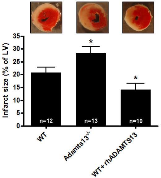 Figure 1. Infarct volumes after transient LAD occlusion in WT mice, Adamts13−/− mice and WT mice treated with rhADATMS13. Top: Representative TTC stains of transverse sections of the left ventricle (LV) of the 3 groups after 1 hour of LAD occlusion followed by 23 hours of reperfusion. Infarctions appear as white. Bottom: Myocardial infarctions (expressed as percentage of the LV) of the 3 groups as measured by planimetry at day 1 after LAD occlusion (*P < .05 compared with the WT group).