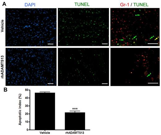 Figure 3. rhADAMTS13 reduces myocardial apoptosis after transient LAD occlusion. (A) Representative immunofluorescent DAPI (blue), TUNEL (green), and Gr-1 (red) stainings of sections from the ischemic area in the hearts of mice that received rADAMTS13 or vehicle. Apoptosis was absent in nonischemic areas (not shown). The higher magnification of the double stain (Gr-1/TUNEL) shows that majority of TUNEL-positive cells are not Gr-1–positive, that is, they are green rather than yellow (arrows). (B) The apoptotic index of both groups was determined by calculating the percentage of apoptotic cells (measured in 3 different view fields per section, 4 sections per mouse with 3 mice per group, ***P < .001). Scale bar = 50 μm.