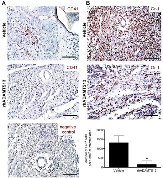 Figure 4. Treatment with rhADAMTS13 reduces neutrophil infiltration and affects microthrombi events during myocardial ischemia/ reperfusion injury. After 1 hour of LAD occlusion and 23 hours of reperfusion, hearts from mice treated with either vehicle or rhADAMTS13 were harvested and sectioned for immunohistochemical analysis. (A) CD41 staining of heart sections. Adherent platelets, positive for CD41 (brown arrows), were seen only in some vessels and were detected only in vehicle, but not in rhADAMTS13-treated mice. Bottom: negative control staining without a primary antibody. (B) Gr-1–expressing neutrophils (brown color) infiltrated ischemic myocardium of vehicle-treated mice but significantly less did so in rhADAMTS13-treated mice. Bottom: Gr-1–positive cells in the ischemic area were counted in 5 different fields of view per section and numbers were expressed as positive cells per 1 mm2 of infracted area (3 mice per group, **P < .01). Scale bar = 100 μm.