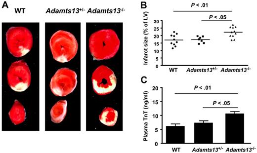 Figure 1. ADAMTS13 deficiency promotes acute myocardial I/R injury. (A) Representative triphenyl-2,3,4-tetrazolium-chloride–stained heart sections from one mouse of each genotype after 30 minutes of ischemia and 23.5 hours of reperfusion injury. The infarcted area is white. (B) Quantification of the infarct size (n = 7-10/group). Each dot represents a single mouse. Horizontal bars indicate mean values. (C) Plasma cardiac TnT levels (n = 7-10 /group). Data are means ± SEM.