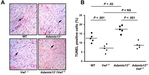 Figure 5. ADAMTS13 deficiency promotes myocyte apoptosis, whereas VWF-deficiency prevents it. (A) Representative photomicrographs stained for apoptotic myocytes using the TUNEL method and counterstained with hematoxylin from 1 mouse of each genotype. TUNEL positive cells are stained red and indicated by black arrows. (B) Quantification of TUNEL-positive cells in the infarcted region. Each dot is a mean of 16 fields from 4 serial sections (separated by 30 μm) per mouse. Horizontal bars indicate mean values. NS indicates nonsignificant.