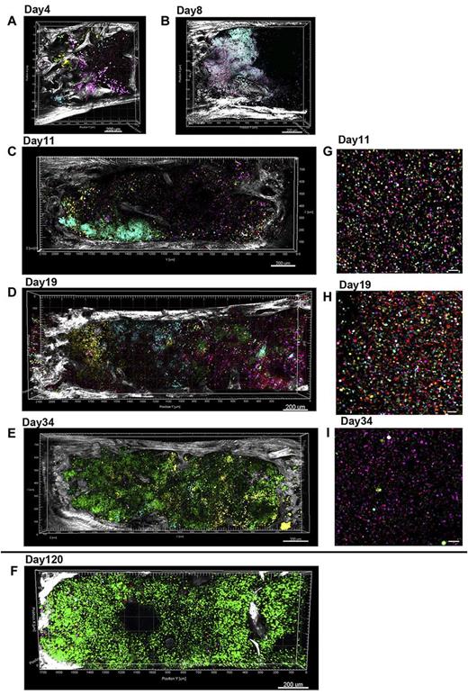 Figure 3. Engraftment and expansion of transplanted 5FP-marked cells in the BM in vivo. Lin− cells transduced with 5FPs were infused into mice after total body irradiation. Bisected whole sternal mounts were examined at different time points by confocal and 2-photon microscopy (A-F). Peripheral blood nucleated cells from the same time point are shown to the right of each sternal marrow image (G-I). For all images, tiled z-stacks were collected over large volume (2.5-mm × 1.2-mm × 300-μm) of the mouse BM tissue and computationally stitched. (A-E) Different mice, each receiving the same population of Co 5FP–transduced donor cells. (F) Different experiment of Mix 5FP–transduced donor cells. Related images are found in supplemental Videos 4 and 5. (A-B) Endosteal engraftment occurring early in BM regeneration (day 4 and 8 after transplantation, respectively); clusters of cells marked in wide variety of colors were visible in close proximity to the bone edge (SHG, white). (C) By day 11, multiple cell clusters are located in close proximity to the bone and progressing centrally over time. (D) By day 19, multiple uniquely color-marked clones are distinguishable over the entire marrow fossae. (E) By day 34, one large clone (green) has expanded to occupy the entire fossae. However, the peripheral blood from the same time point (I) continues to show the presence of multiple clones contributing to hematopoiesis. (F) Day 120 sternum is shown from another experiment, with animals receiving Mix 5FP–transduced BM, similarly showing a very large single clone occupying most of the sternal marrow space. Scale bars represent 200 μm (A-F), 50 μm (G-H).